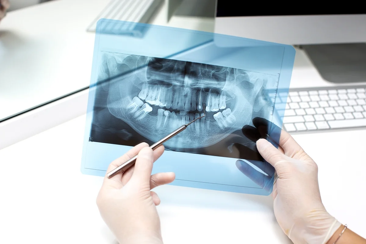 Estudo encontra 19 substâncias químicas nos dentes de crianças com autismo