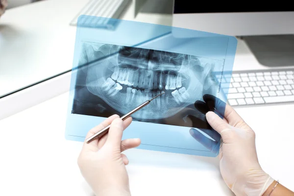 Estudo encontra 19 substâncias químicas nos dentes de crianças com autismo
