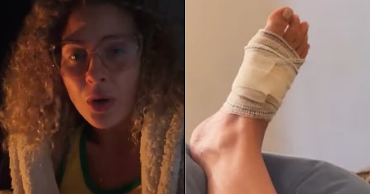 Debby Lagranha passa por procedimento cirúrgico após picada de aranha e necrose no pé