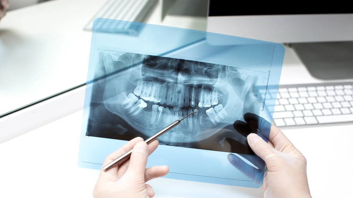 Estudo encontra 19 substâncias químicas nos dentes de crianças com autismo