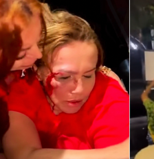 Iara Pimentel é atingida em ato de apoio a Lula Foto: Reprodução